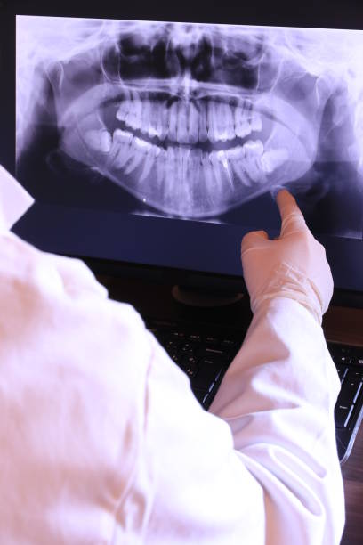 Best Emergency Dental Care for Broken or Chipped Teeth in East St Louis, IL