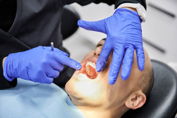 Best Emergency Root Canal Treatment in East St Louis, IL