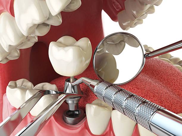 Best Cosmetic Emergency Dentistry in East St Louis, IL